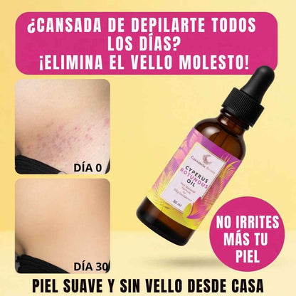 Cyperus Rotundus Oil - Elimina el vello y la irritación de tu zona íntima